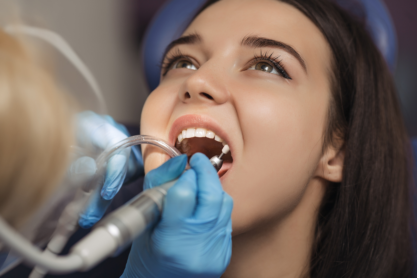 Essential Aftercare Tips for a Smooth Recovery After Tooth Extraction